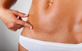 cliniques de gynecomastie en marseille Docteur Roger Darmani - Chirurgien esthétique